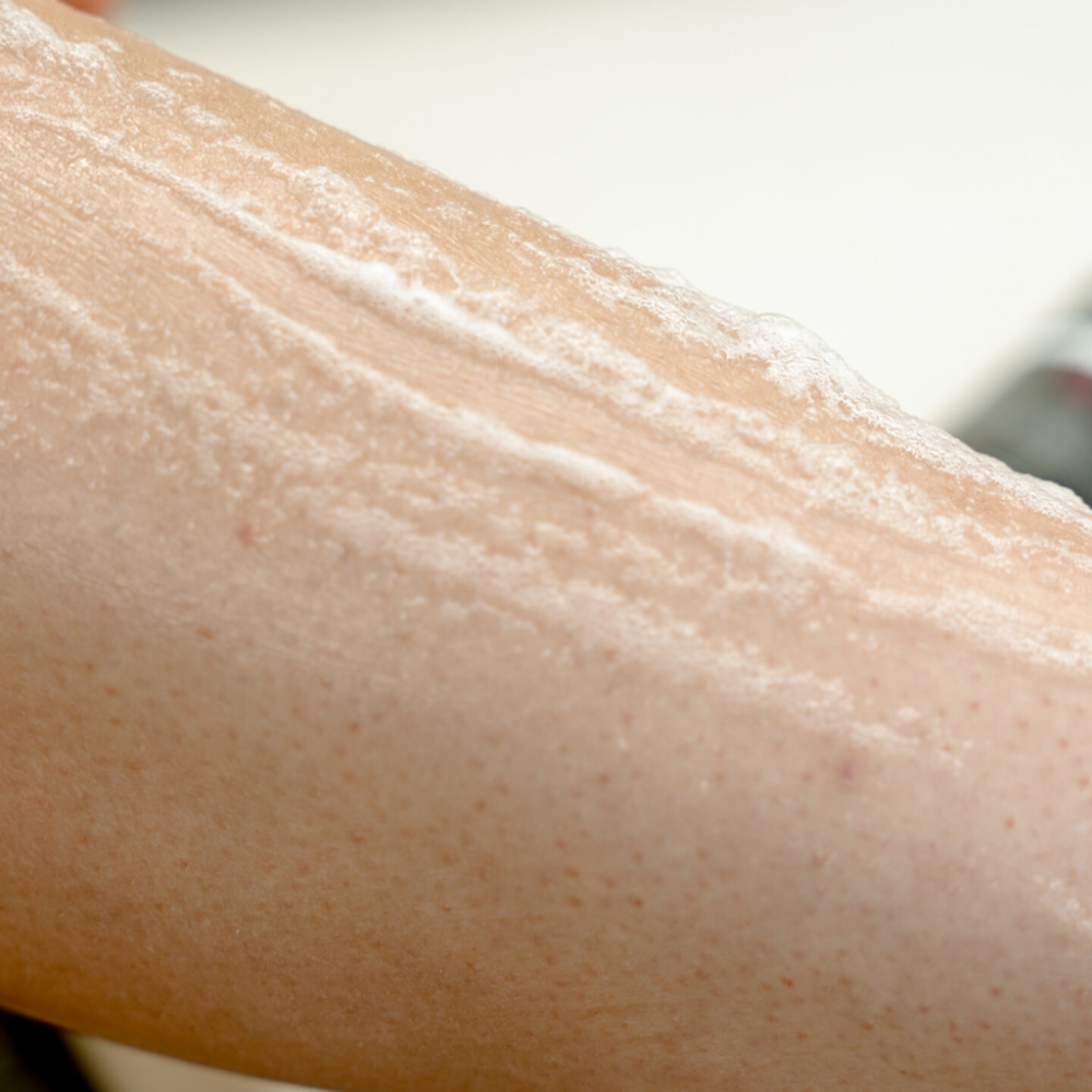 DYNAMIC Rapid Recovery