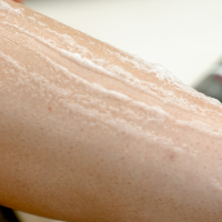 DYNAMIC Rapid Recovery